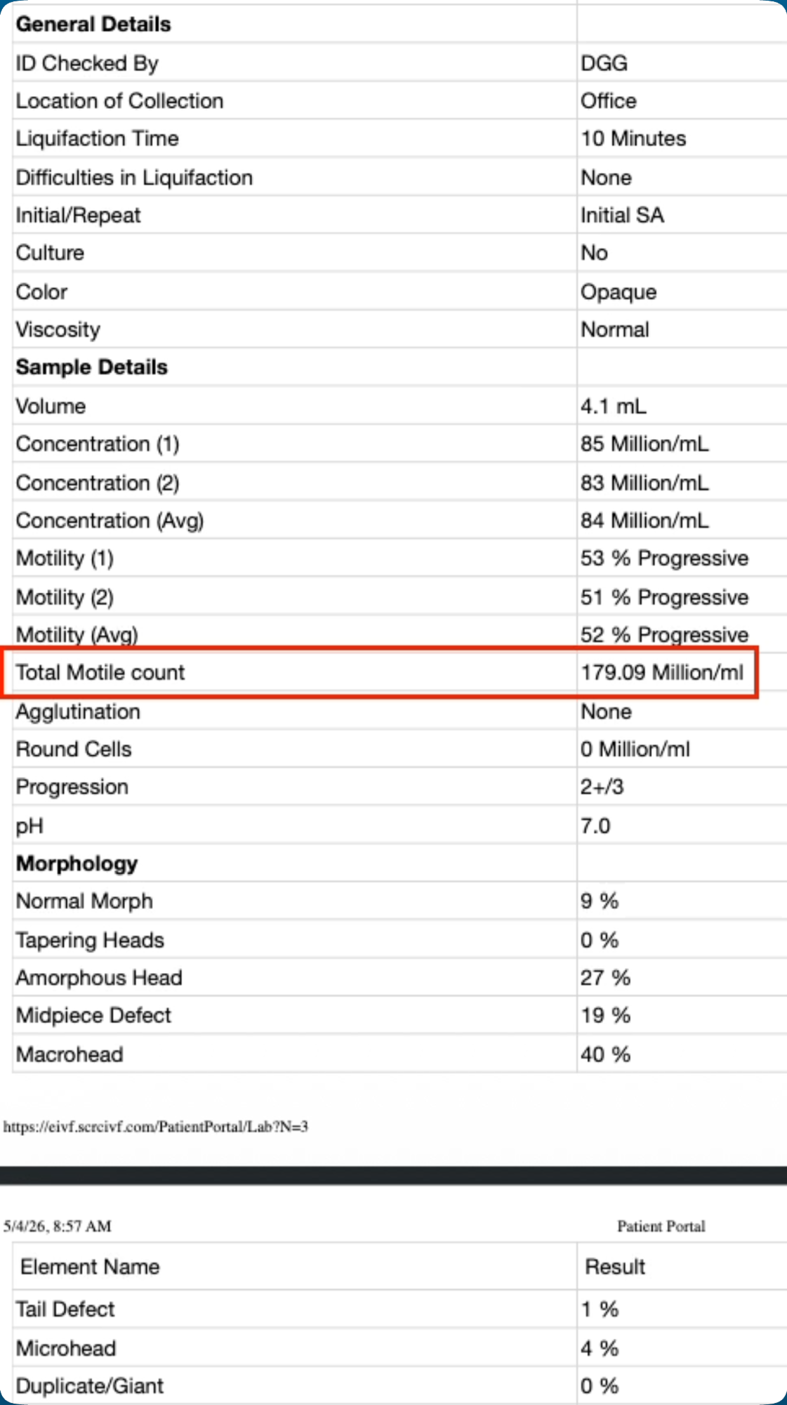 Clinical semen analysis showing 4.1 mL volume, 84 M/mL average concentration, 52% progressive motility, 179.09M total motile count, and 9% normal morphology